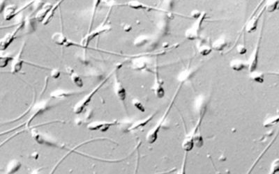 7. The Sperm Collection Procedures