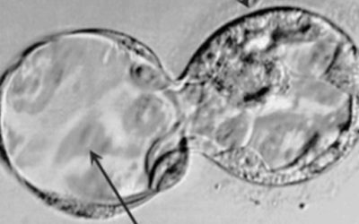11. Post Embryo Transfer